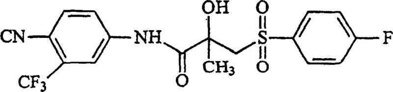 Chemical structure of Bicalutamide (Casodex) showing the chiral center and functional groups
